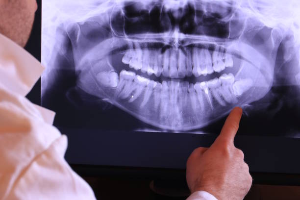 Best Dental Abscess Treatment in Newark, TX